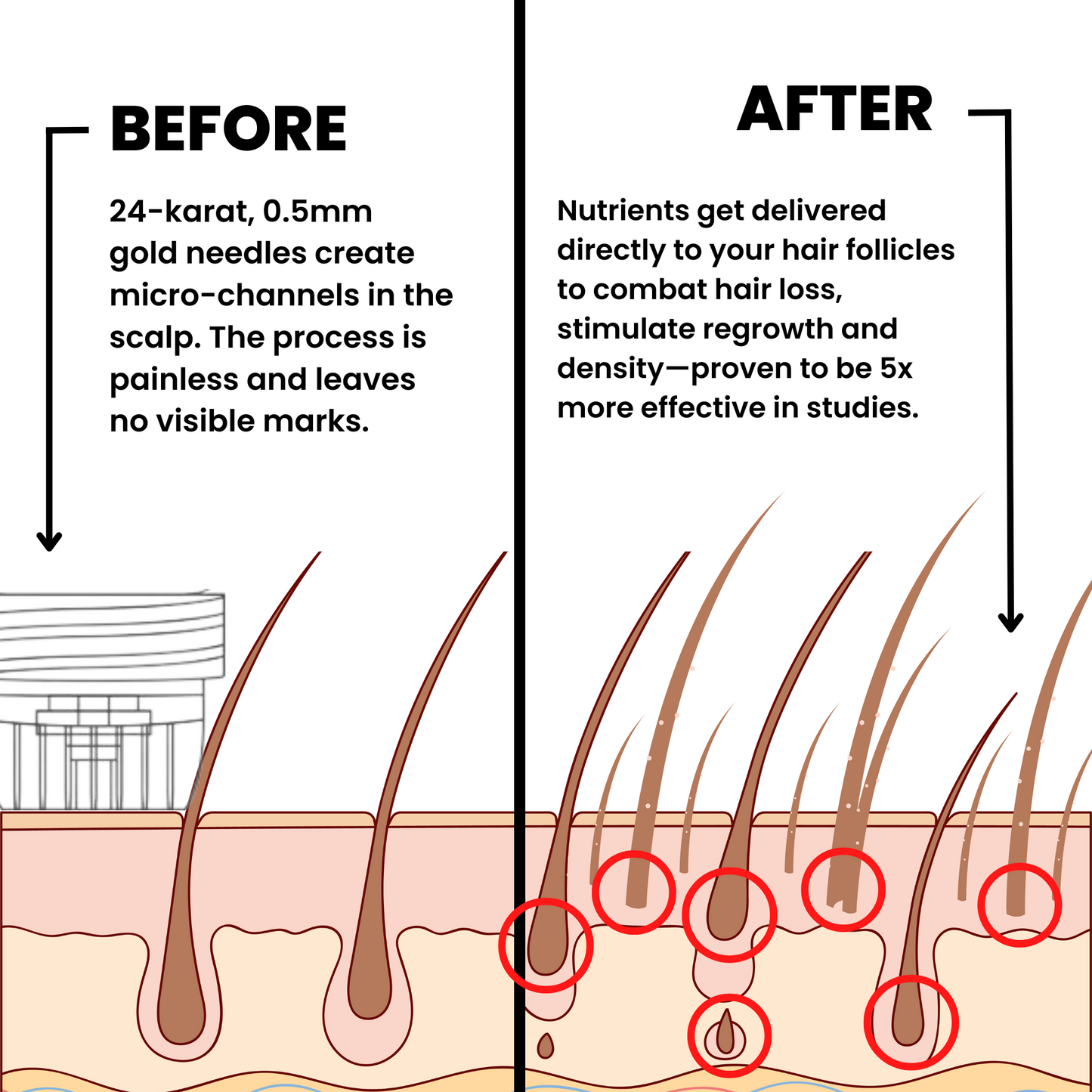 InfusionLabs™ Hair Regrowth System