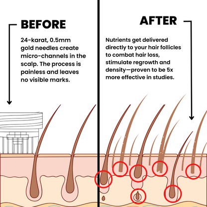 InfusionLabs™ Hair Regrowth System