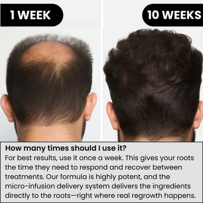 InfusionLabs™ Hair Regrowth System