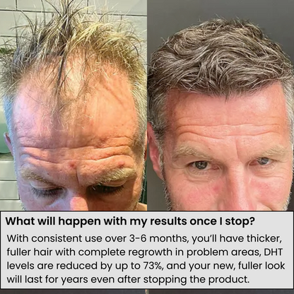 InfusionLabs™ Hair Regrowth System